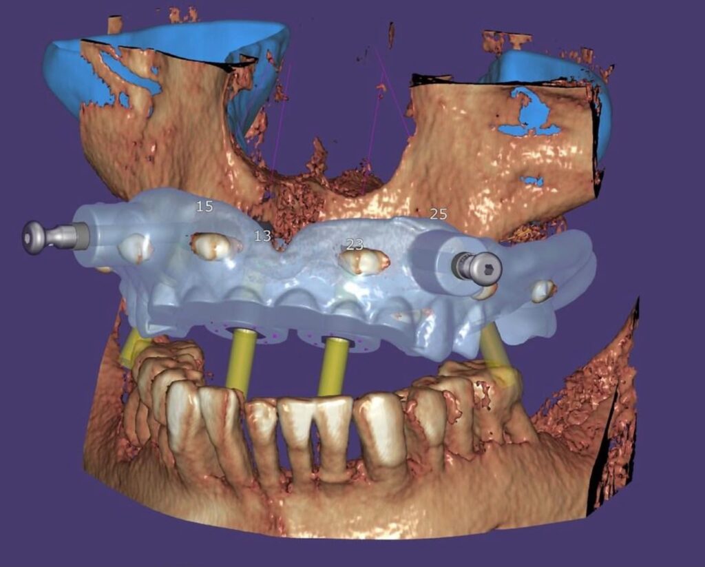 DC17 03 - Clínica Dss: tecnología digital para recuperar tu sonrisa