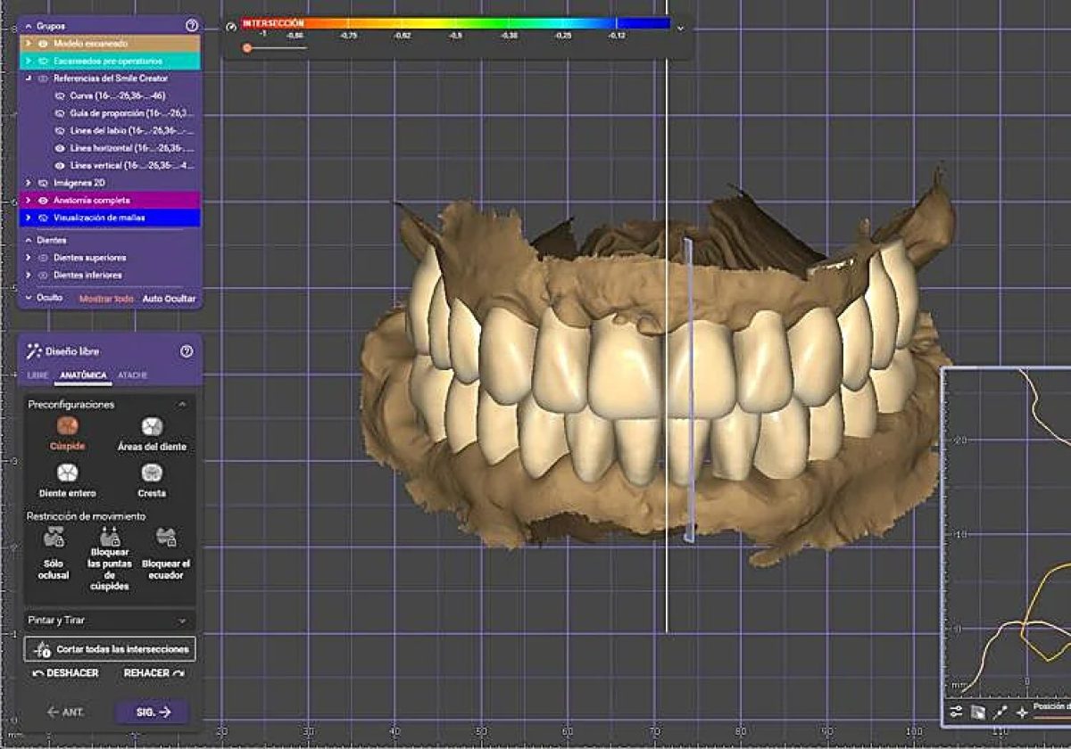 Modelo digital 3D para la planificación de tratamientos dentales